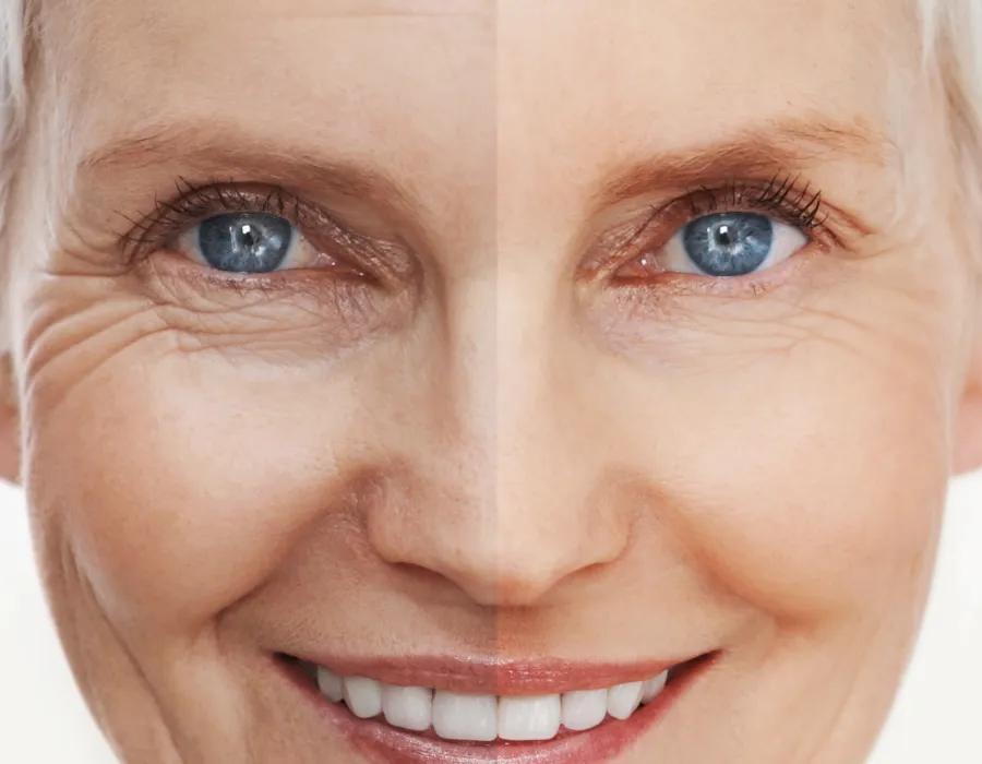 TriPollar® Eye Contour Firming